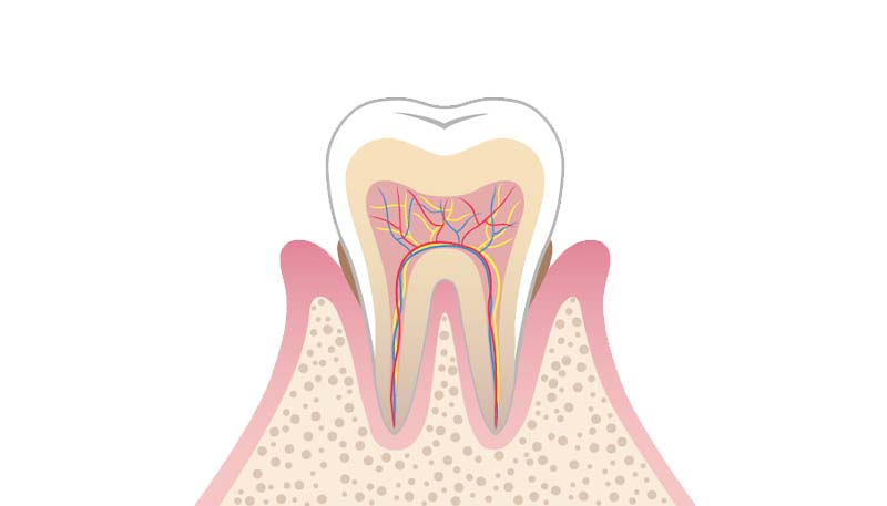 軽度歯周病